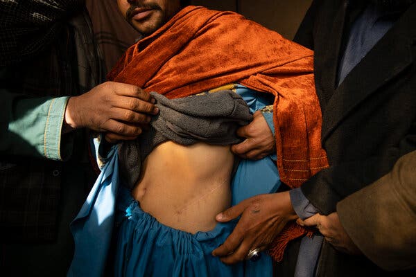 In Afghanistan, a Booming Kidney Trade Preys on the Poor