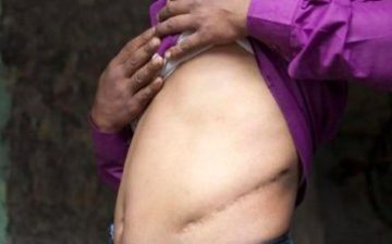 The village of “Kidney Valley” is at the nexus of poverty and organ trafficking