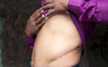 The insidious trade of human organs keeps growing but is still being ignored