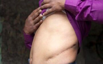 The chilling and growing industry of forced organ harvesting
