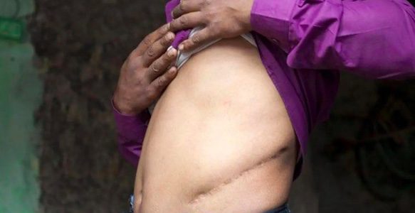 The chilling and growing industry of forced organ harvesting