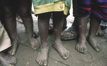 Child labor in Africa powering clean energy boom