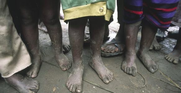 Child labor in Africa powering clean energy boom